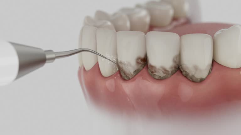 Reliable Dental contractor in Gates Mills, OH by Smile Center Dentistry